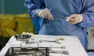 Búi giun hơn 100 con làm tắc ruột bé trai Búi giun hơn 100 con làm tắc ruột bé trai