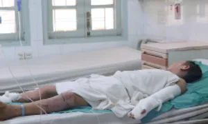 Chế pháo nổ, bé trai bỏng cháy cơ thể Chế pháo nổ, bé trai bỏng cháy cơ thể
