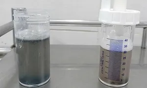 Tim, phổi 4 nạn nhân vụ cháy quán hát bị tổn thương do khí độc, muội than Tim, phổi 4 nạn nhân vụ cháy quán hát bị tổn thương do khí độc, muội than
