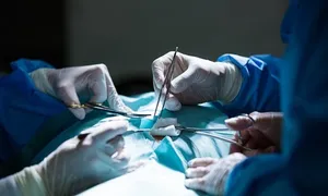 Sốc mất máu sau làm đẹp vùng kín Sốc mất máu sau làm đẹp vùng kín