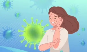 Cách ngăn cơn đau zona thần kinh Cách ngăn cơn đau zona thần kinh