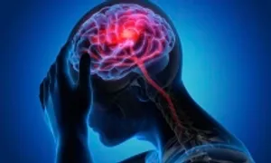 Những thời điểm dễ đột quỵ nhất Những thời điểm dễ đột quỵ nhất