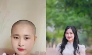 Cú sốc của những người trẻ mắc ung thư Cú sốc của những người trẻ mắc ung thư
