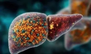 Kiểm tra nguy cơ mắc viêm gan B