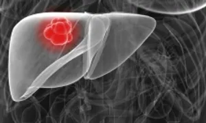 Những dấu hiệu thường gặp cảnh báo gan tổn thương